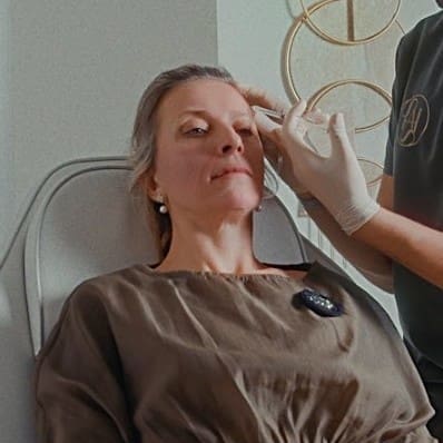 How Many Units of Botox Do You Need? Breakdown by Area