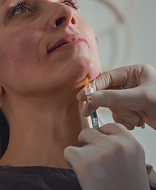 Nefertiti Neck Lift Treatment at Dr Hass Clinic