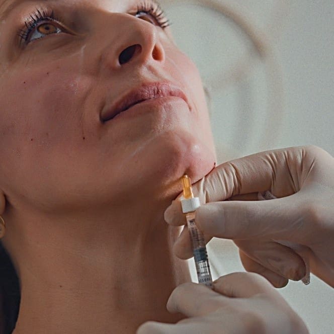 Nefertiti Neck Lift Treatment at Dr Hass Clinic