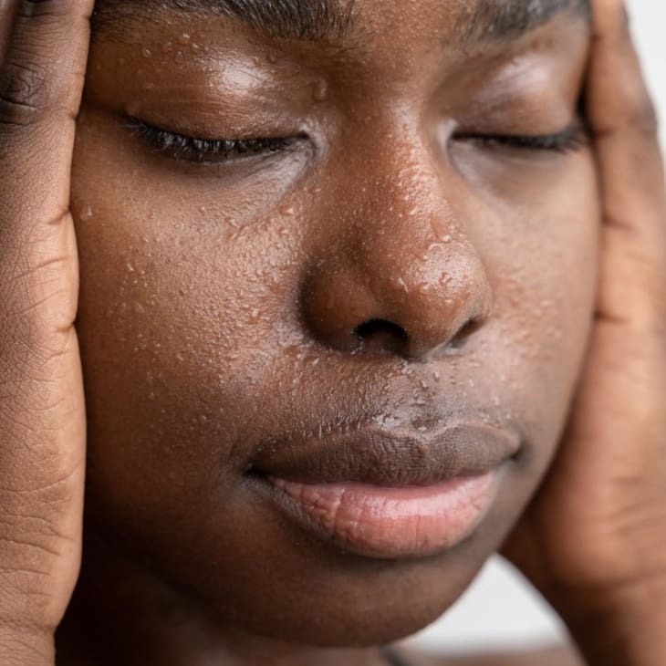 Portrait of Woman with Excessive Sweating - Dr Hass Clinic