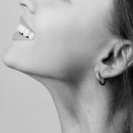 Nefertiti neck lift