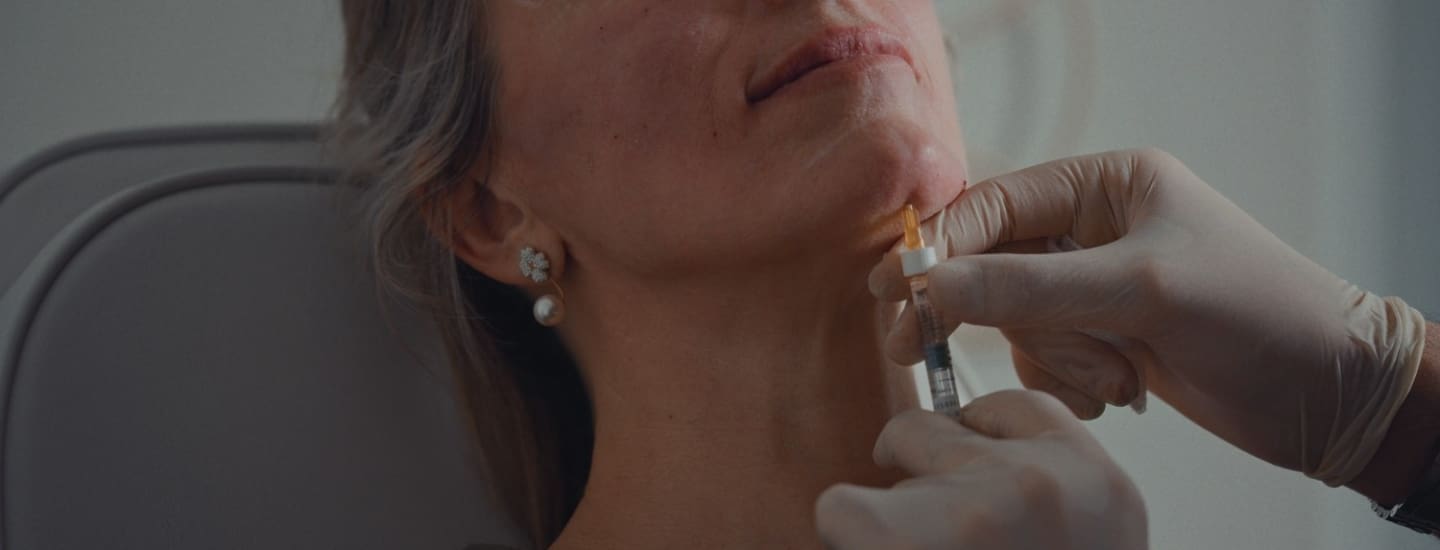 Chin Filler Stage Image - Dr Hass Clinic