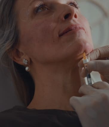 Chin Filler Stage Image - Dr Hass Clinic