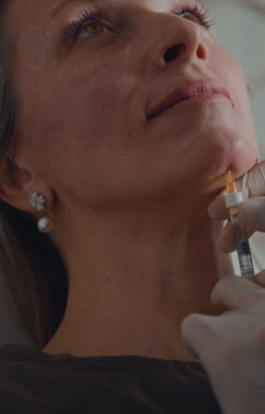 Chin Filler Stage Image - Dr Hass Clinic