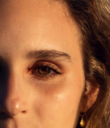 Age Spots