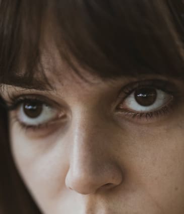 Dark Circles