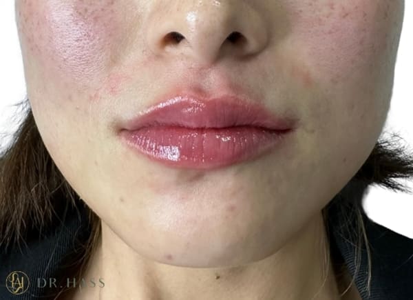 Lips