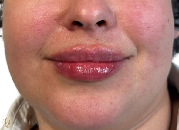 Lips