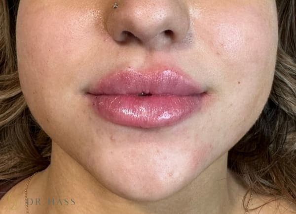 Lips