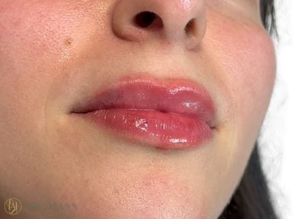 Lips