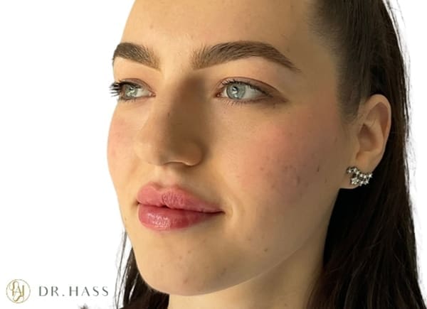 Lips