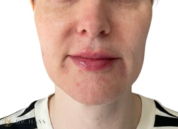 Lips
