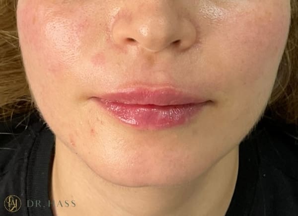 Lips