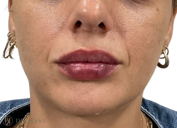 Lips