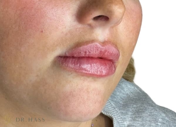 Lips