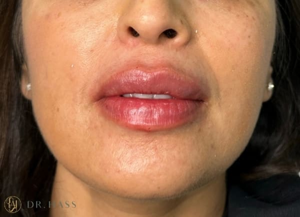 Lips