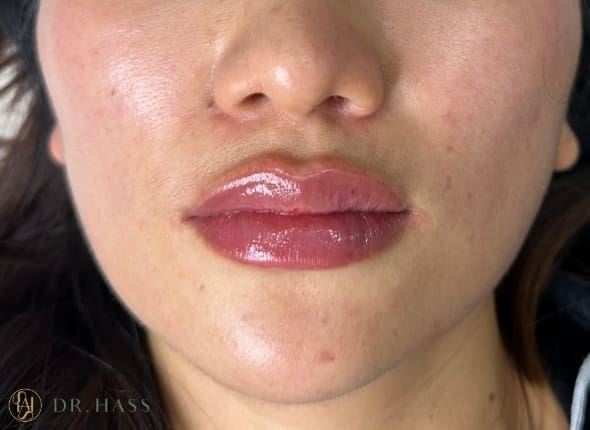 Lips