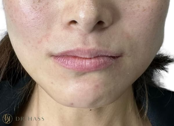 Lips
