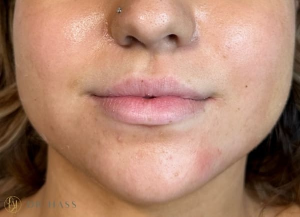 Lips