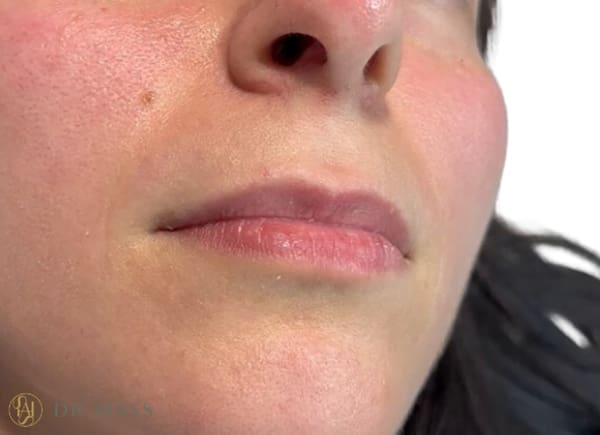 Lips