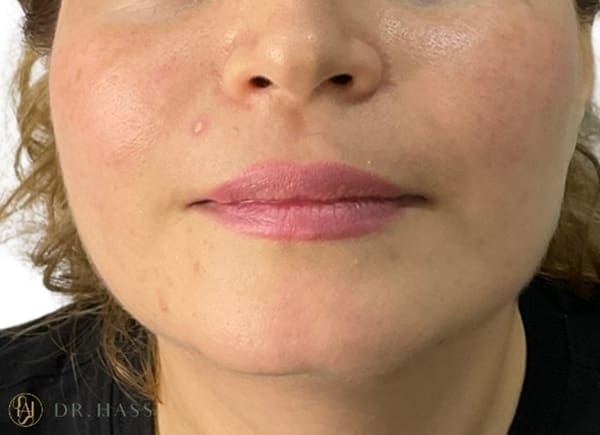 Lips
