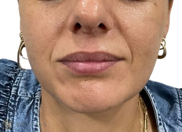 Lips