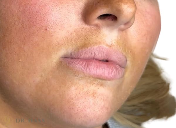 Lips