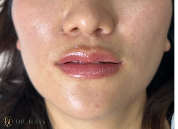 Lips