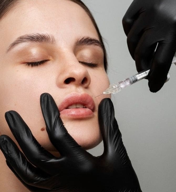 Filler Dissolving (Hyaluronidase) Image - Dr Hass Clinic