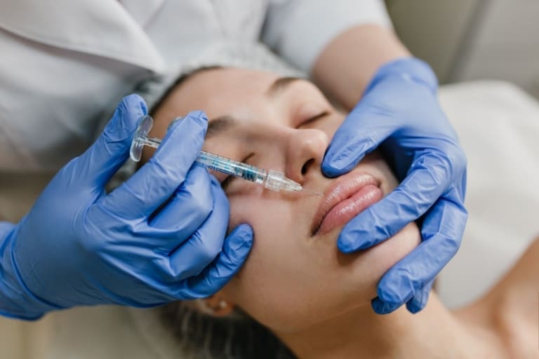 Lip Filler
