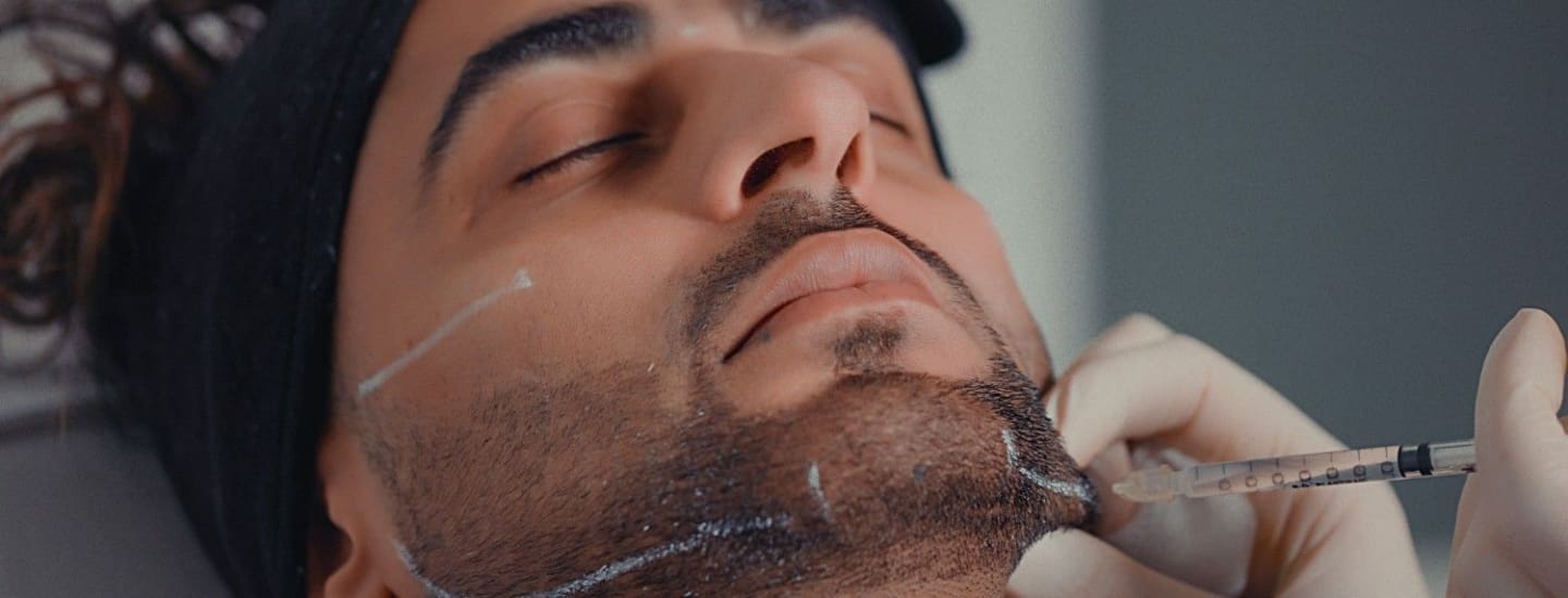 Masseter Botox Stage Image - Dr Hass Clinic