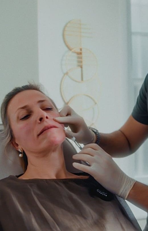 Nasolabial Filler Treatment Stage Image - Dr Hass Clinic