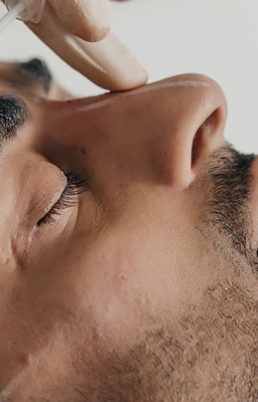 Nose Filler Treatment Stage Image - Dr Hass Clinic (Mobile)