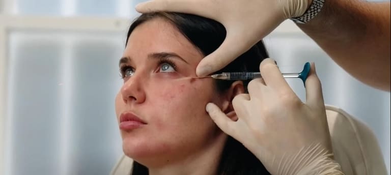 Tear Trough Filler