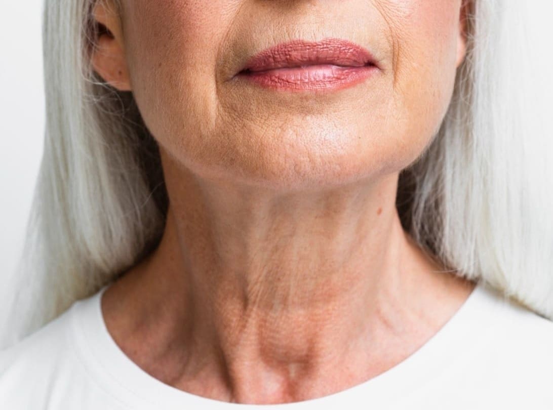 Jowls and Sagging Skin: Causes, Prevention and Treatments