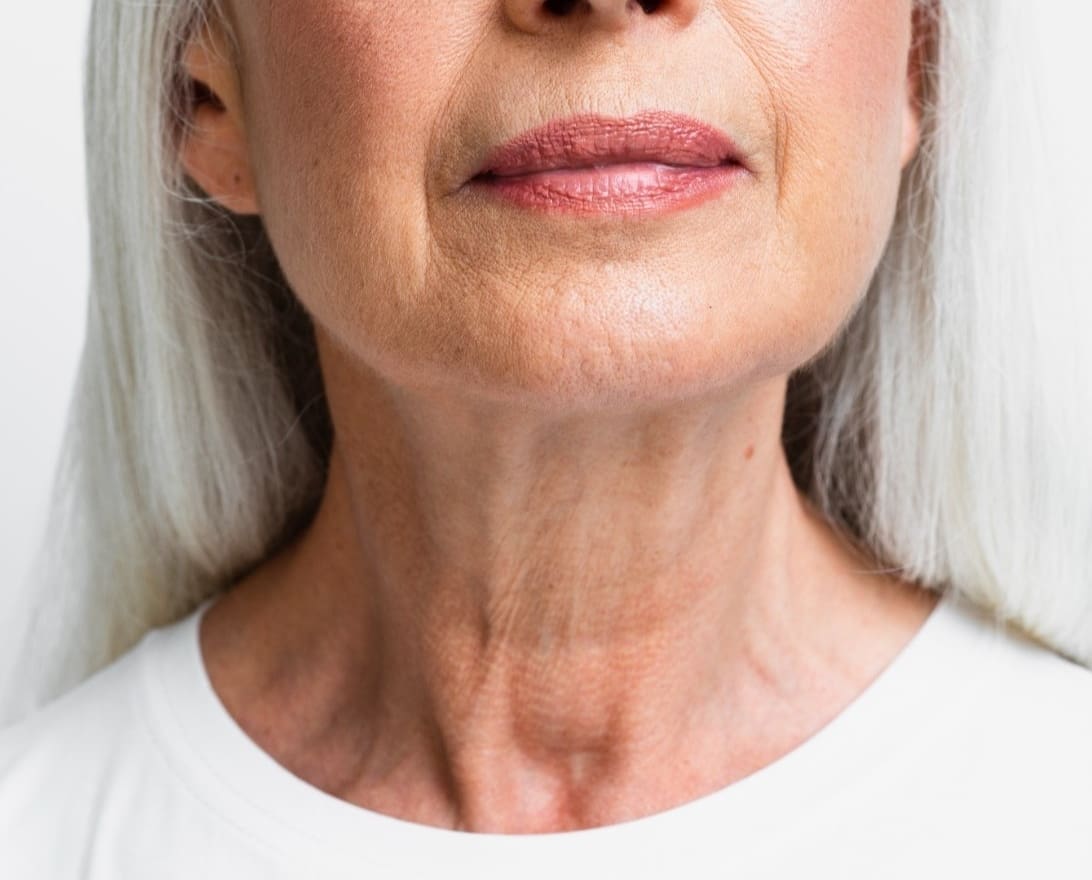 Jowls and Sagging Skin: Causes, Prevention and Treatments