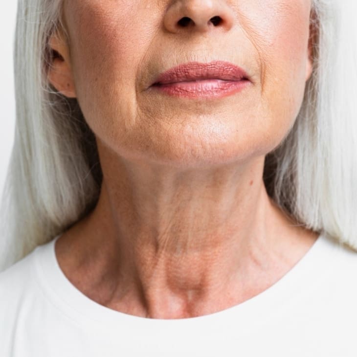 Jowls and Sagging Skin: Causes, Prevention and Treatments