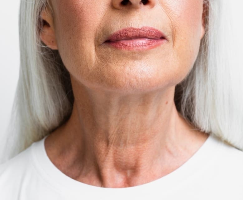 Jowls and Sagging Skin: Causes, Prevention and Treatments