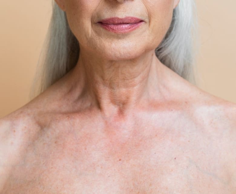 Wrinkly Chest: Causes, Prevention and Treatments