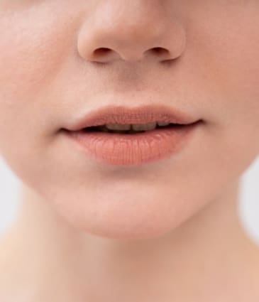 Thin Lips: Causes, Prevention and Treatment