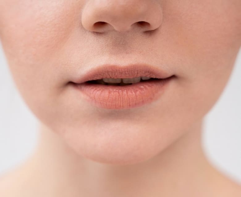 Thin Lips: Causes, Prevention and Treatment