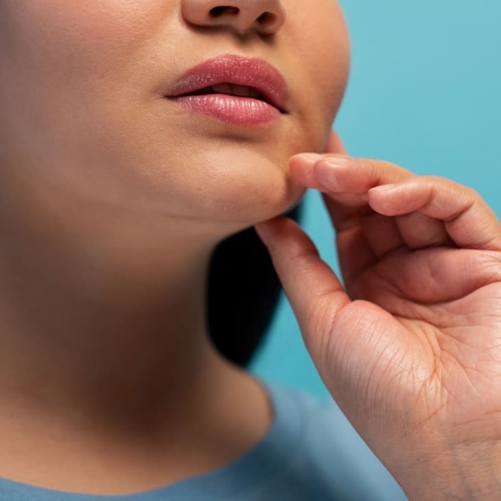 Chin Concerns: Causes, Prevention and Treatments