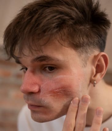 Dry and Dull Skin - Dr Hass Clinic