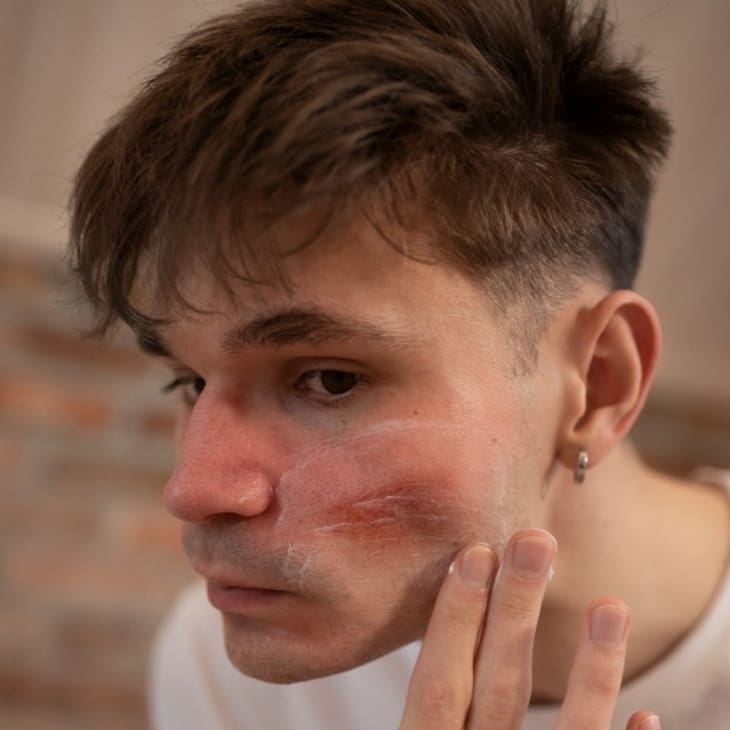 Dry and Dull Skin - Dr Hass Clinic