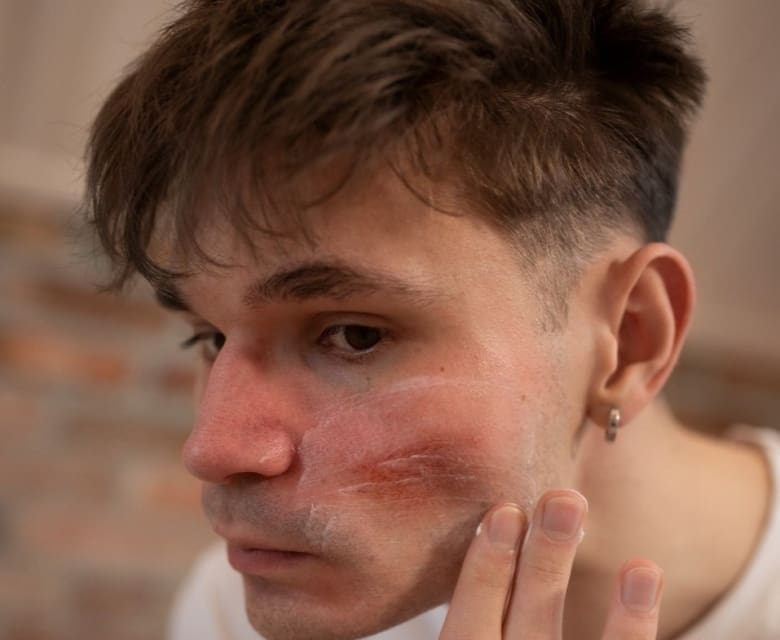 Dry and Dull Skin - Dr Hass Clinic