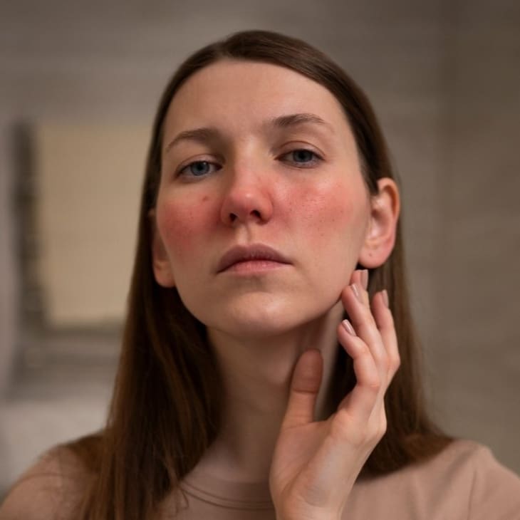 woman-dealing-with-uneven-skin-tone (1)