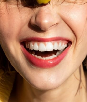 Gummy Smile: Causes, Prevention and Treatments