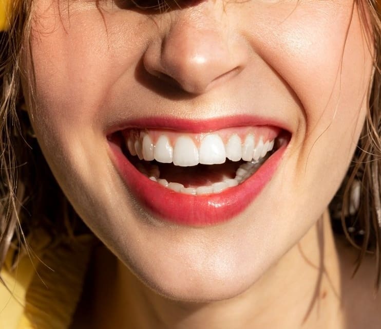 Gummy Smile: Causes, Prevention and Treatments