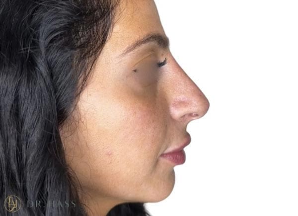 Dr Hass - Profile Balancing