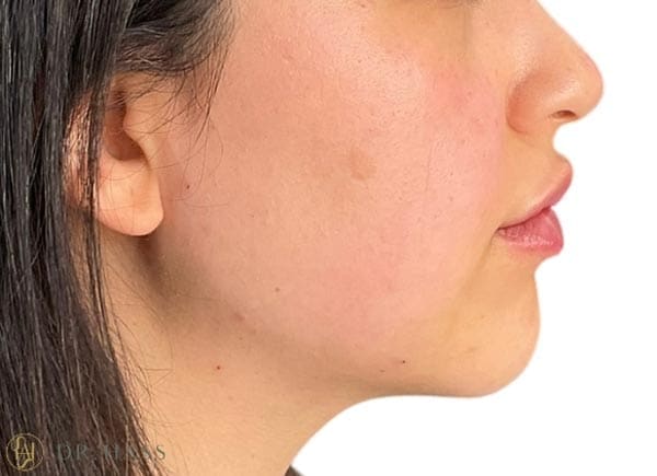 Dr Hass - Profile Balancing